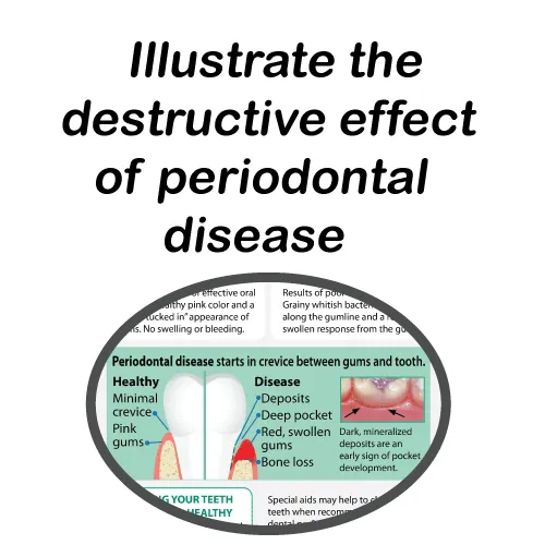 Effective Flossing and Brushing